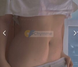 Ảnh Sex @betun Onlyfans Nàng Thơ Mình Dây Loli Lồn Múp 159 Ảnh Sex @betun Onlyfans Nàng Thơ Mình Dây Loli Lồn Múp